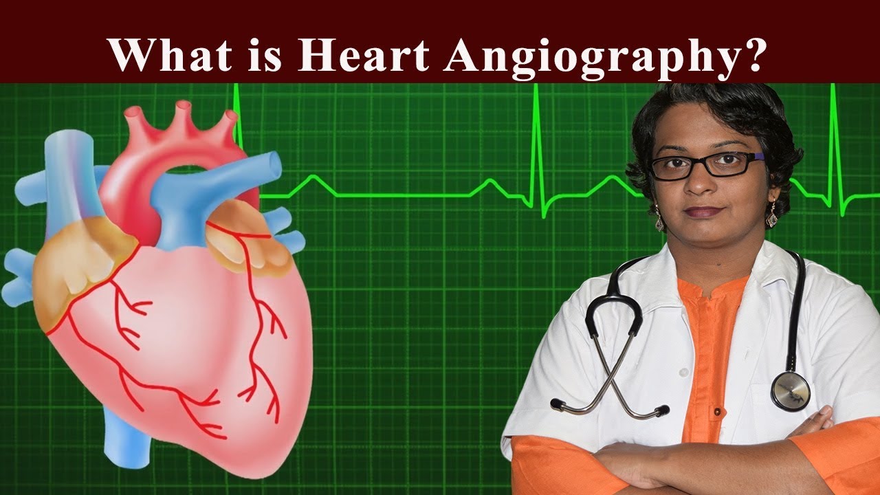 What is Heart Angiography? Explained by Dr. Wagh - YouTube