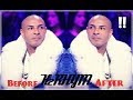تطور كادوريم من      إلى               حالتي