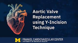 Cardiac Surgery Simplified: Aortic Valve Replacement using Y-Incision Technique