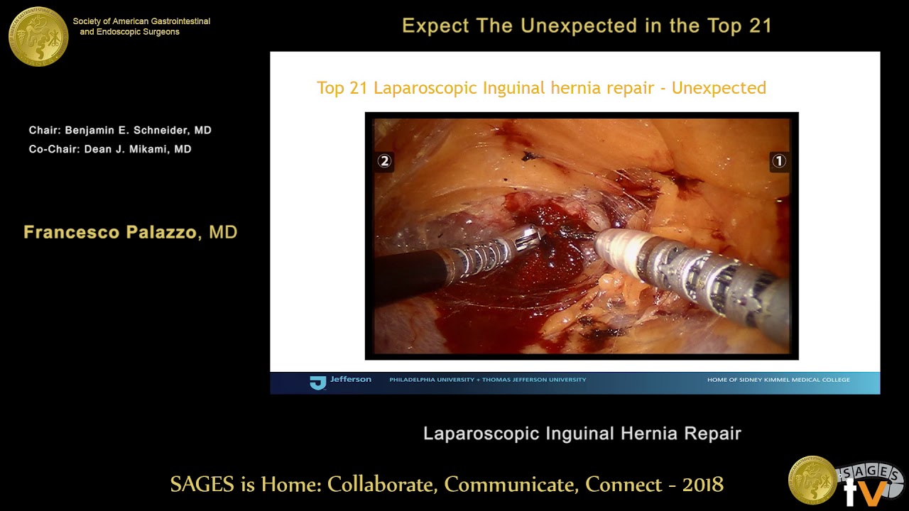 Inguinal Hernia Repair Surgery Patient Information from SAGES