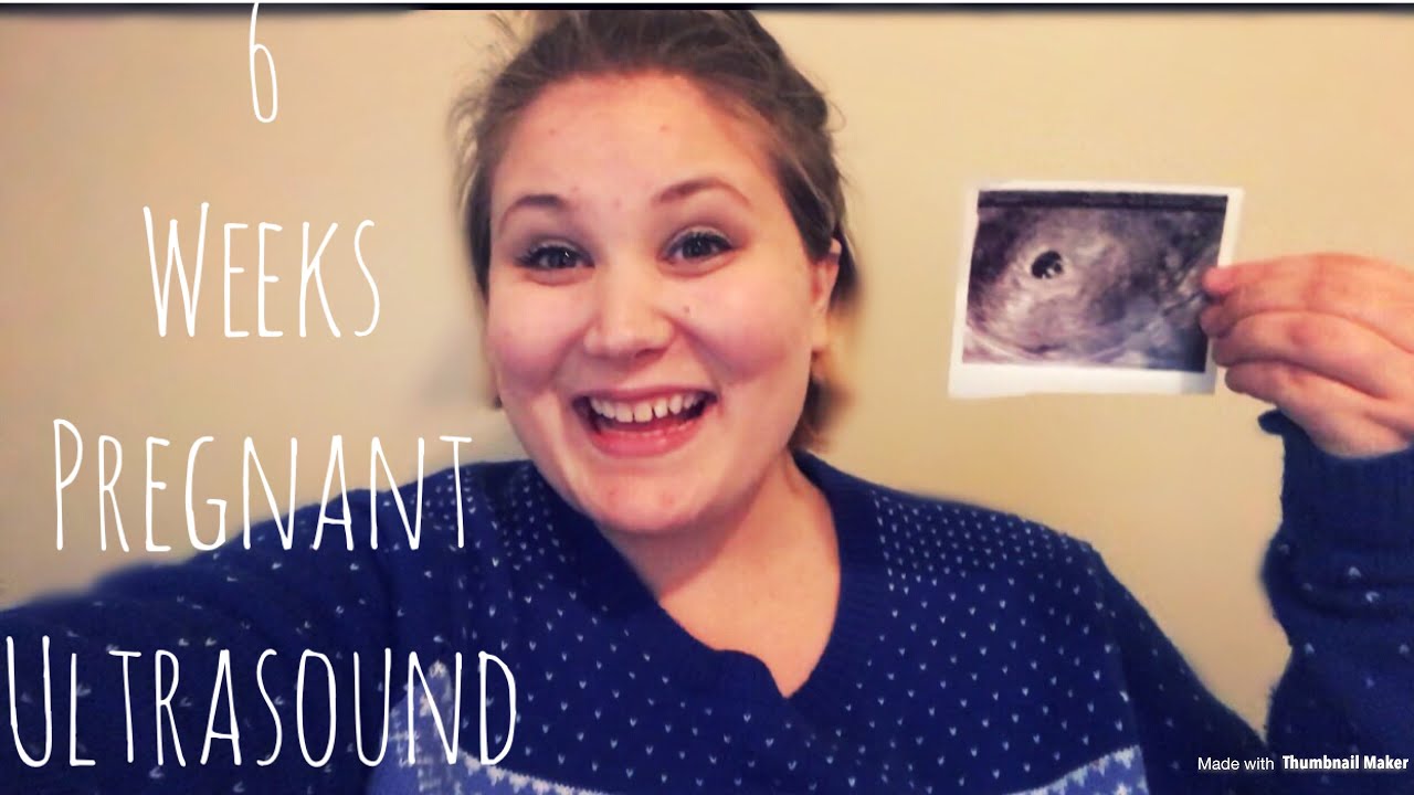 6 WEEKS PREGNANT ULTRASOUND - YouTube