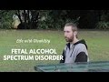 Fetal Alcohol Spectrum Disorder