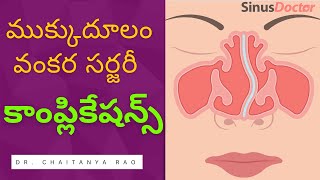 ముక్కు దూలం సర్జరీ కాంప్లికేషన్స్ | Dr. Chaitanya Rao by Sinus Doctor 20,991 views 1 year ago 15 minutes