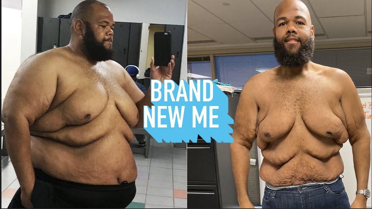 I Lost 250lbs - Now I'm Proud Of My Body | BRAND NEW ME