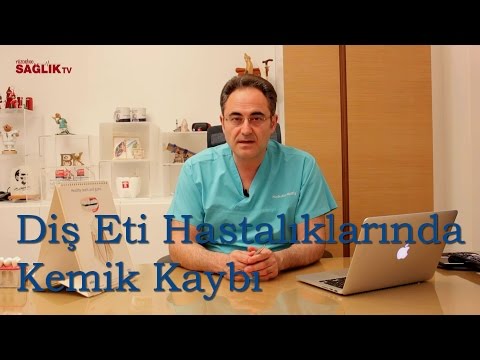 Diş Eti Hastalıklarında Kemik Kaybı - Prof Dr Bülent Kurtiş