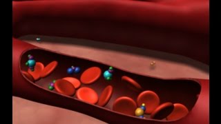 Preventing Iatrogenic Anemia