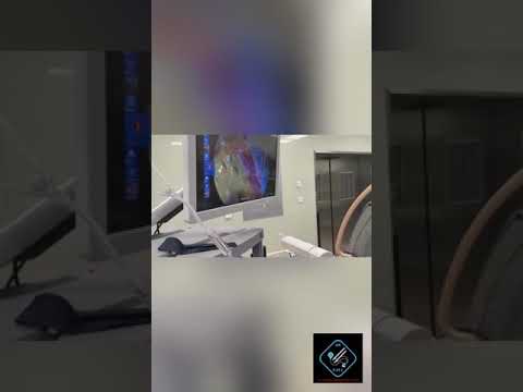 عملية ازالة حصى الكلى من ثقب صغير من الظهر بالمنظار عملية  د أمجد المسلماني