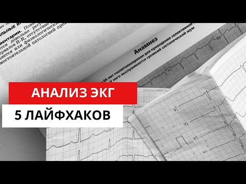 5 особенностей (лайфхаков) при АНАЛИЗЕ ЭКГ.