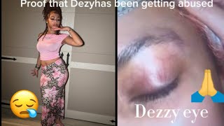 Proof That Dezy Is Getting Abused