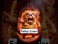 Fatty Liver