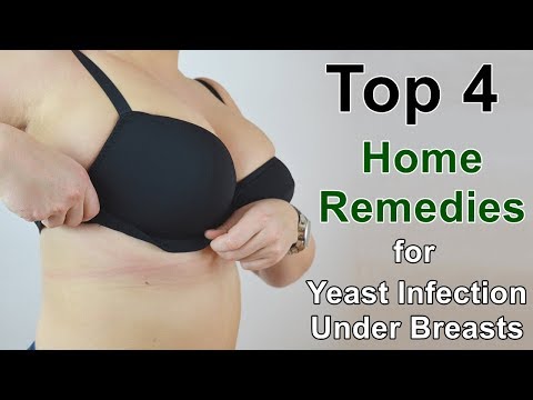 Home Remedies for Yeast Infection Under Breasts - These Work Well