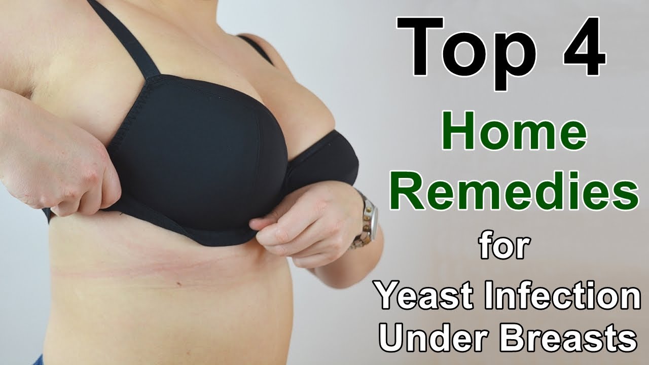 Home Remedies for Yeast Infection Under Breasts - These Work Well