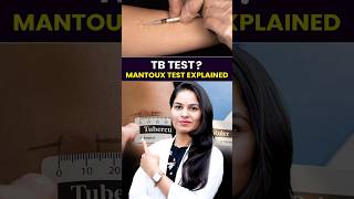Mantoux Test in Hindi | TB Skin Test | Positive vs Negative | Manisha Maam #healthawareness #shorts