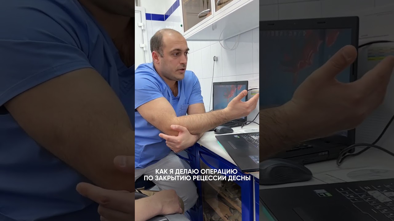 На консультации по лечению рецессии рассказываю, как проходит пластика десны и показываю кейсы.