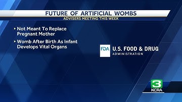 FDA looks into 
