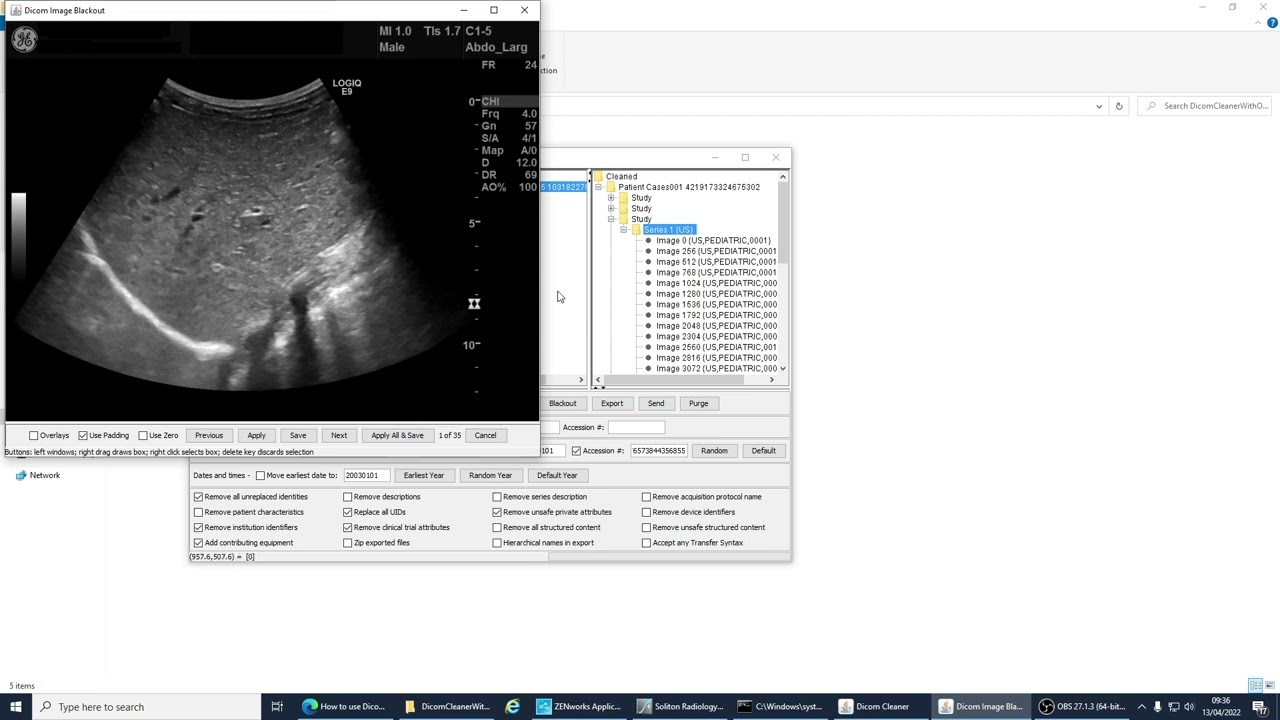 Anonymising DICOM data