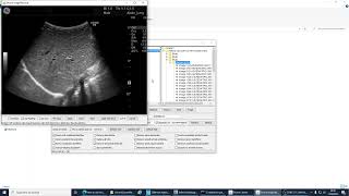 Anonymising DICOM data