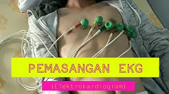 PEMASANGAN EKG ( ELEKTROKARDIOGRAM ) SESUAI SOP - Durasi: 9.29. 
