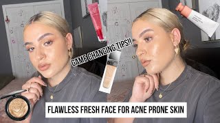 FLAWLESS FRESH FOUNDATION ROUTINE FOR ACNE PRONE SKIN/ACNE SCARRING!! | ** MUST HAVE PRODUCTS **