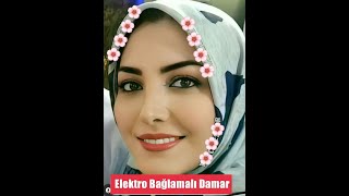 Kime Kin Ettin Giydin Alları - Elektro Bağlamalı Damar - Amasyalı Ferhat Türküleri
