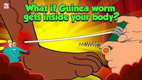 Deadliest Parasite | What if Guinea Worm Gets Inside Your Body? | Dracunculiasis | Dr Binocs Show