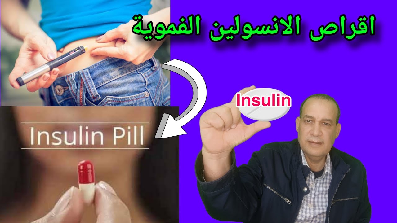 اقراص الانسولين الفموية لعلاج السكري.. Insulin pill