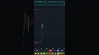 Stock trading vs Option trading 2026,Day - 27 #tradingbasics #tradingforbeginners