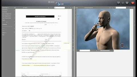 XBundle Product Demo