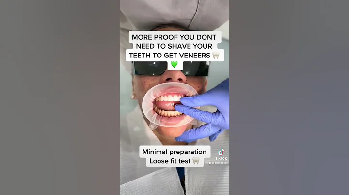 Primo Dental EMAX Veneers Loose Fit Test! #shorts