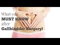 Rapid Weight Loss After Gallbladder Removal