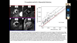BENG280C L15 MRI applications