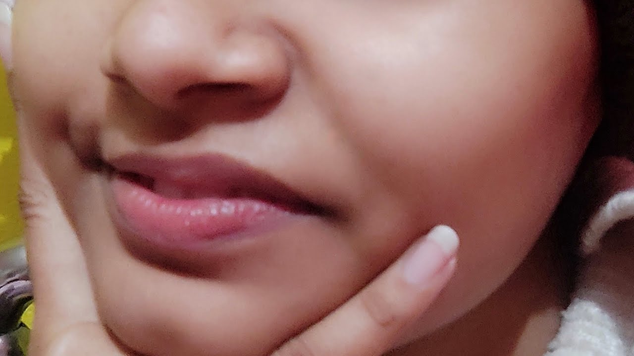 Getting my braces off: 