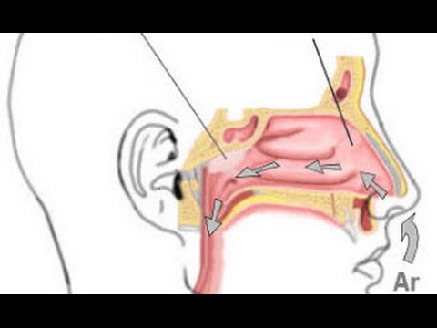 Vídeo: Adenoides De Grado 2 En Niños: Tratamiento, Fotos, Revisiones, Extirpación, Cirugía