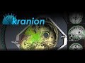 Kranion transcranial focused ultrasound treatment modeling software tutorial