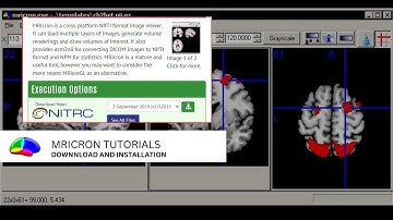 MRIcron Tutorials: Download and Installation