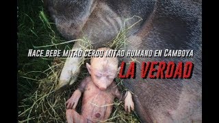 Nace bebe mitad cerdo mitad humano en Camboya 2018. LA VERDAD!!