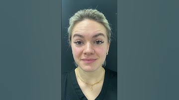 Here’s what your Botox will look like over 7 days! 😱😍