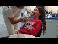 Zahnspange/ 1 Tag Zahnabdruck von Farangiz 😥#FarangizSamira