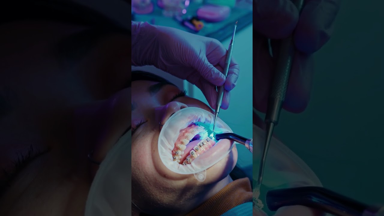 Fix Bad Breath and Gum Problems Naturally: ProDentim Review 2025 for Oral Health. #shorts