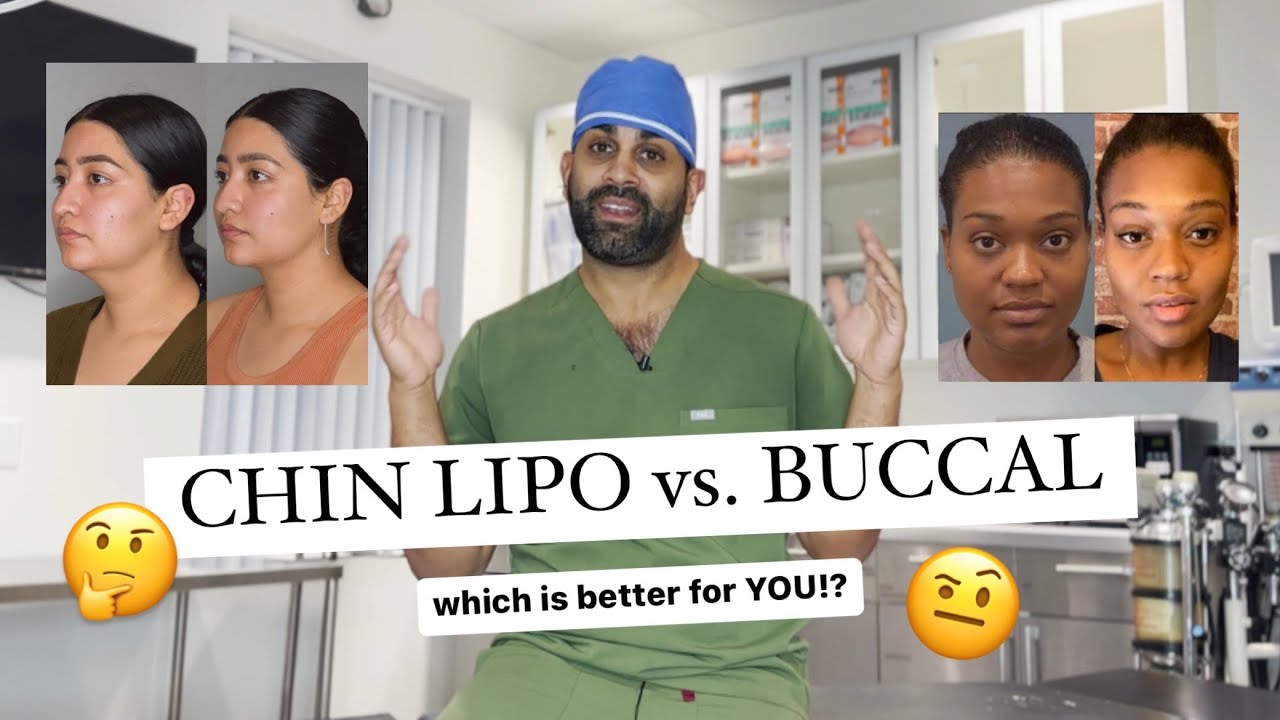 Chin Lipo vs Buccal Fat Removal WHICH IS BETTER!? YouTube