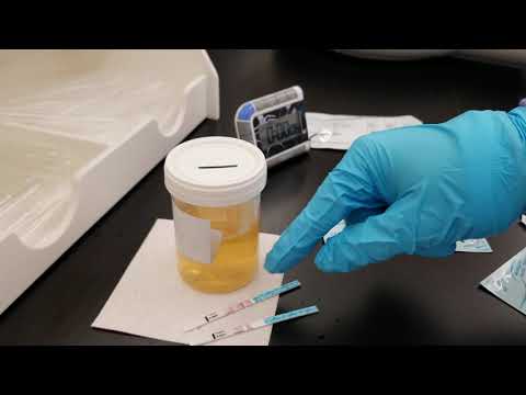 वीडियो: गर्भावस्था के दौरान मूत्र परीक्षण: प्रतिलेख