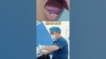 Vai trò của lấy dấu răng kỹ thuật số | Lạc Việt Intech Implant #lvnw #short