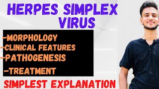 Herpes virus Microbiology // Herpes simplex virus Lecture