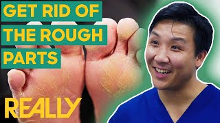 Treating Bad-Looking Feet To Look Healthy Again | The Bad Foot Clinic | Brand New Series