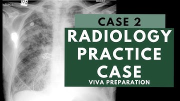 Radiology Viva Practice Case: 2 - FRCR 2B preparation