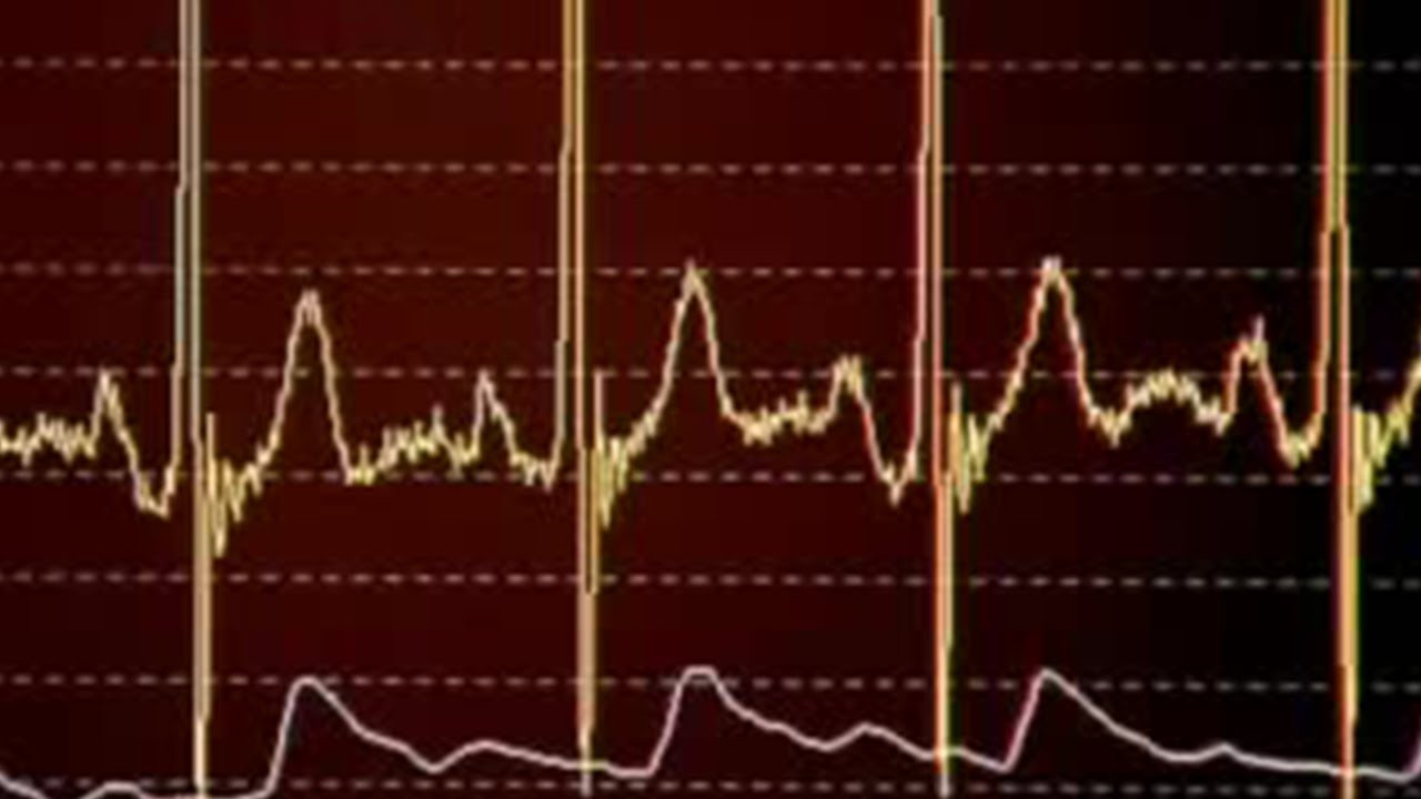 Can Fish Prevent Heart Disease? | BBC