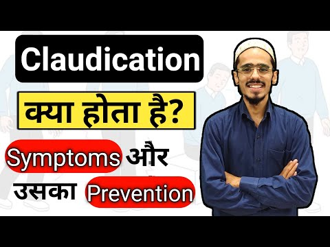 claudication | claudication symptoms | Preventive measures for claudication