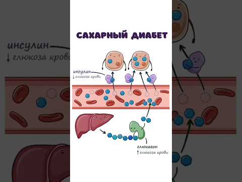 Сахарный Диабет - патогенез (инсулин, глюкагон биохимия)