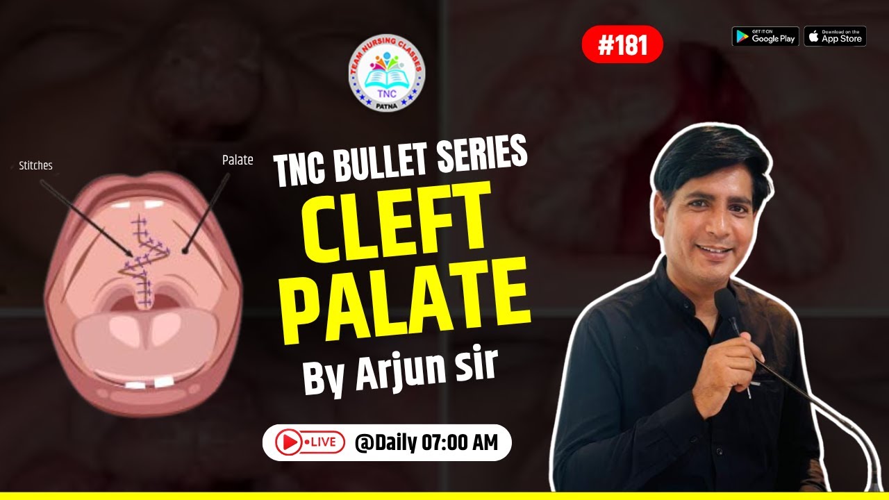 Cleft Palate || TNC Bullet Series # 181 || Most Important Topic || Daily 7.00 AM || NURSING EXAM