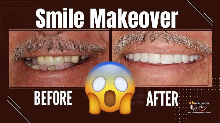 Creating Beautiful Smiles | Before & After Smile Makeover Transformations | KEERTHI SENTHIL DDS, MS
